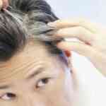 PREMATURE GREYING OF HAIR! SHOULD YOU BE WORRIED?