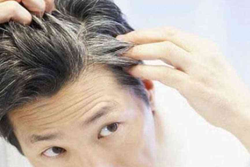 Read more about the article PREMATURE GREYING OF HAIR! SHOULD YOU BE WORRIED?